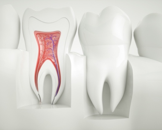 Animated inside of tooth used to explain pulp therapy