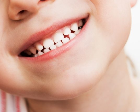 Closeup of child's smile after metal free dental restoration