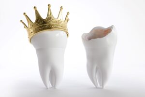 A large model tooth with a crown next to one that's broken on top